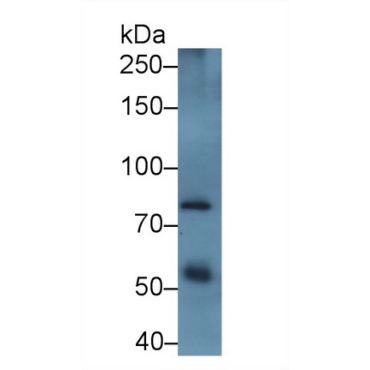 A Disintegrin And Metalloprotease 12 (ADAM12) Human Polyclonal Antibody