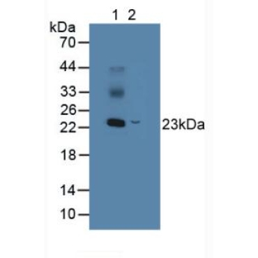 Non Metastatic Cells 5, Protein NM23A Expressed In (NME5) Mouse Polyclonal Antibody