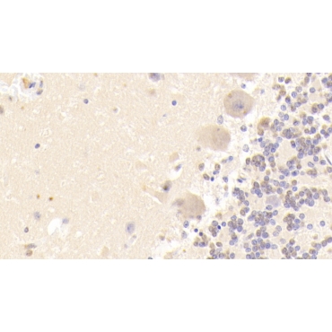 SRC/FGR/YES (FYN) Human Polyclonal Antibody