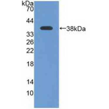 Ataxia Telangiectasia And Rad3 Related Protein (ATR) Human Polyclonal Antibody