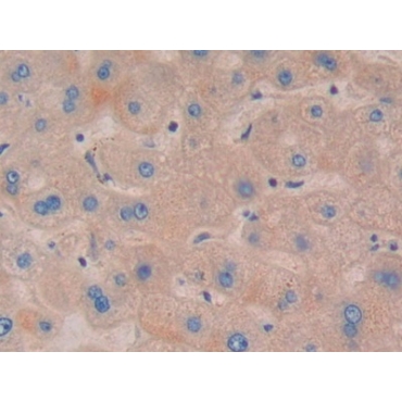 Nucleotide Binding Oligomerization Domain Containing Protein 1 (NOD1) Human Polyclonal Antibody