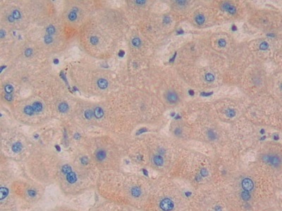 Nucleotide Binding Oligomerization Domain Containing Protein 1 (NOD1) Human Polyclonal Antibody