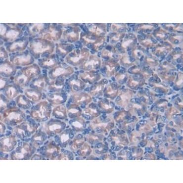 Patched Homolog 1 (PTCH1) Mouse Polyclonal Antibody