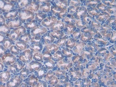 Patched Homolog 1 (PTCH1) Mouse Polyclonal Antibody