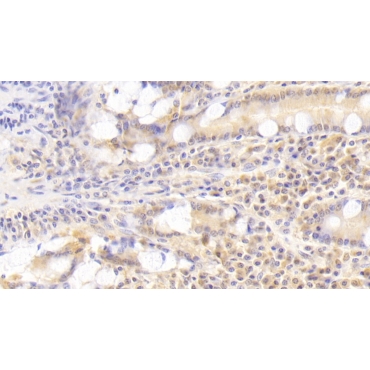 Signaling Lymphocytic Activation Molecule Family, Member 7 (SLAMF7) Human Polyclonal Antibody