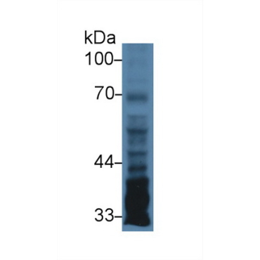 Pentraxin 3, Long (PTX3) Human Polyclonal Antibody
