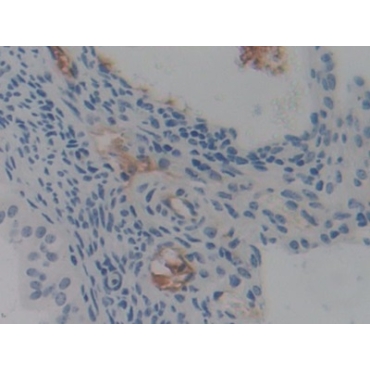 Pentraxin 3, Long (PTX3) Human Polyclonal Antibody