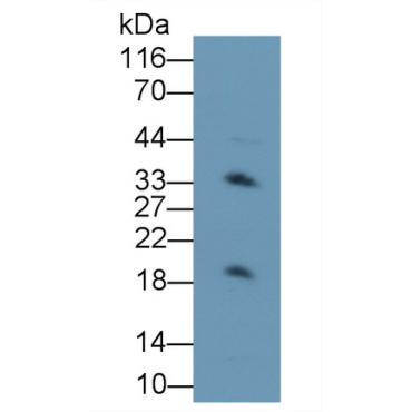Transmembrane Protein 27 (TMEM27) Human Polyclonal Antibody