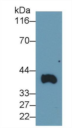 Transmembrane Protein 27 (TMEM27) Mouse Polyclonal Antibody