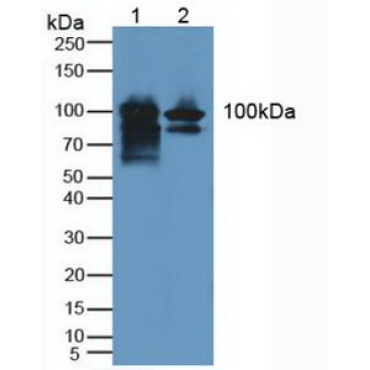 GRB2 Associated Binding Protein 1 (GAB1) Human Polyclonal Antibody