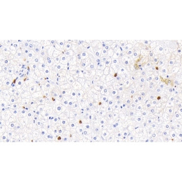 Calprotectin (CALPRO) Human Polyclonal Antibody