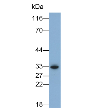 PTEN Induced Putative Kinase 1 (PINK1) Human Polyclonal Antibody
