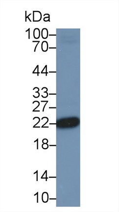 Parkinson Disease Protein 7 (PARK7) Human Polyclonal Antibody