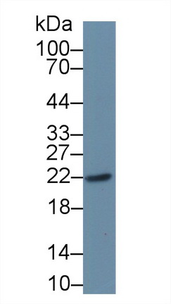 Parkinson Disease Protein 7 (PARK7) Mouse Polyclonal Antibody