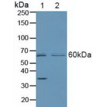 Parkinson Disease Protein 2 (PARK2) Human Polyclonal Antibody