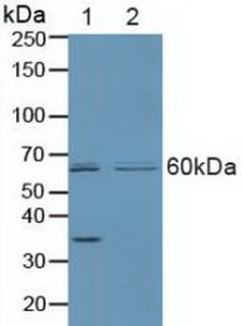 Parkinson Disease Protein 2 (PARK2) Human Polyclonal Antibody