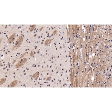 Parkinson Disease Protein 2 (PARK2) Human Polyclonal Antibody