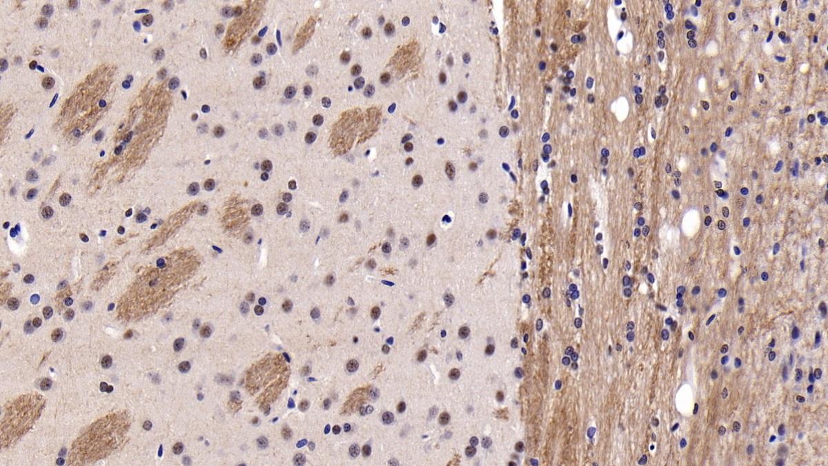 Parkinson Disease Protein 2 (PARK2) Human Polyclonal Antibody