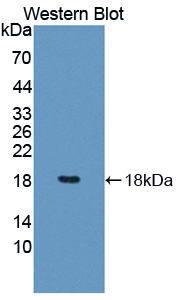 Programmed Cell Death Protein 5 (PDCD5) Human Polyclonal Antibody