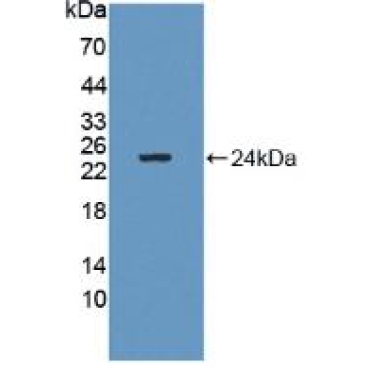 GM2 Ganglioside Activator (GM2A) Human Polyclonal Antibody