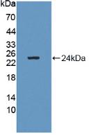GM2 Ganglioside Activator (GM2A) Human Polyclonal Antibody