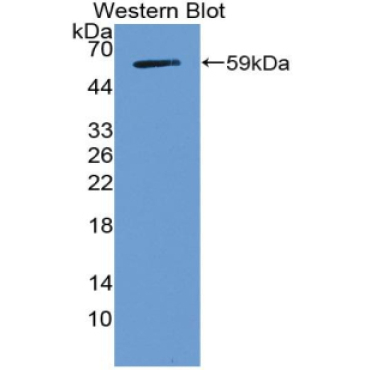 Notch Homolog 3 (NOTCH3) Human Polyclonal Antibody