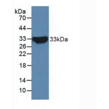 Notch Homolog 2 (NOTCH2) Human Polyclonal Antibody