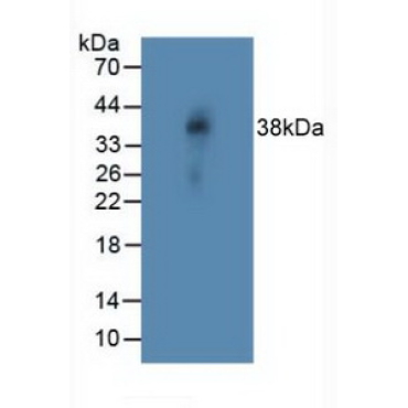 Notch Homolog 4 (NOTCH4) Human Polyclonal Antibody