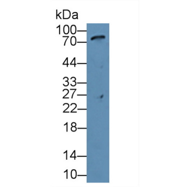 Angiogenic Factor With G Patch And FHA Domains 1 (AGGF1) Human Polyclonal Antibody