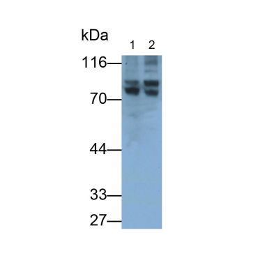 Angiogenic Factor With G Patch And FHA Domains 1 (AGGF1) Human Polyclonal Antibody