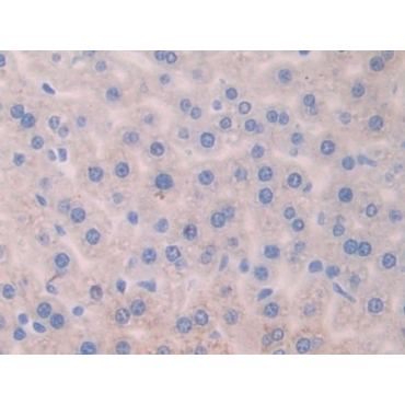 Angiogenic Factor With G Patch And FHA Domains 1 (AGGF1) Mouse Polyclonal Antibody