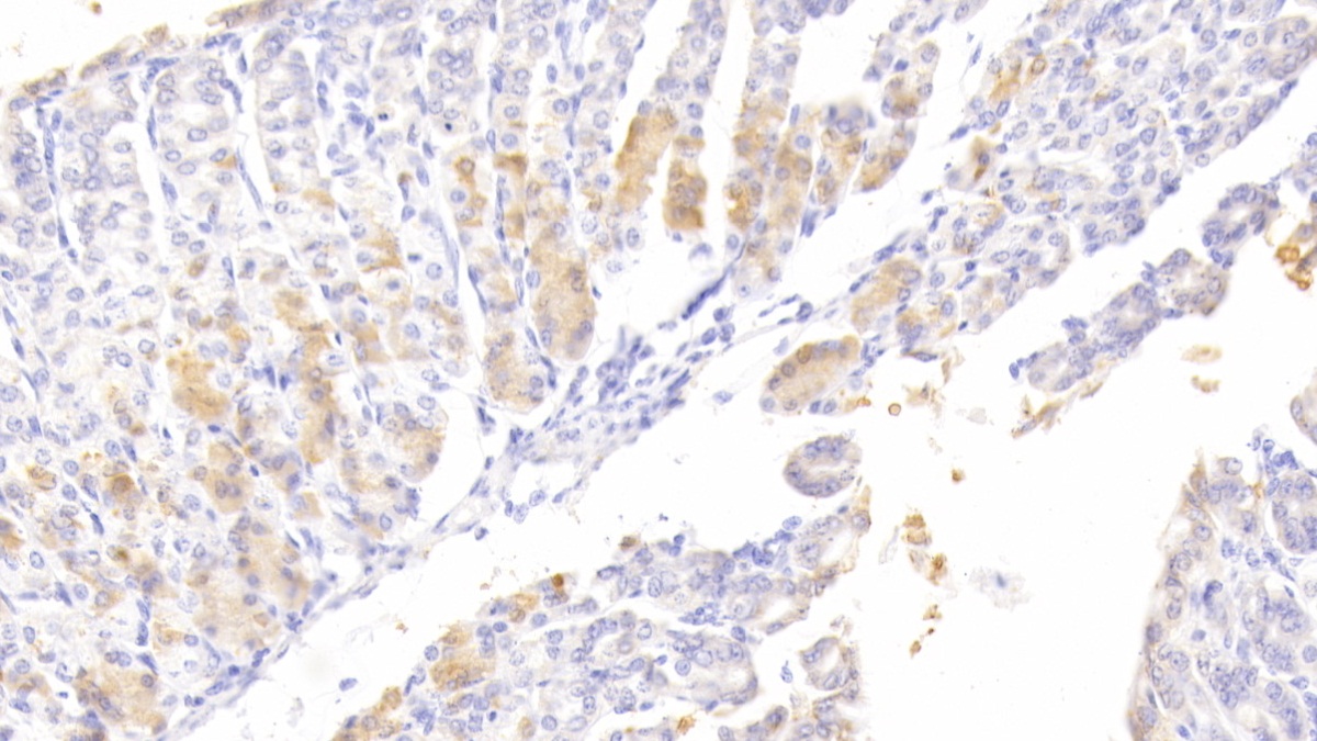 Autophagy Related Protein 7 (ATG7) Mouse Polyclonal Antibody