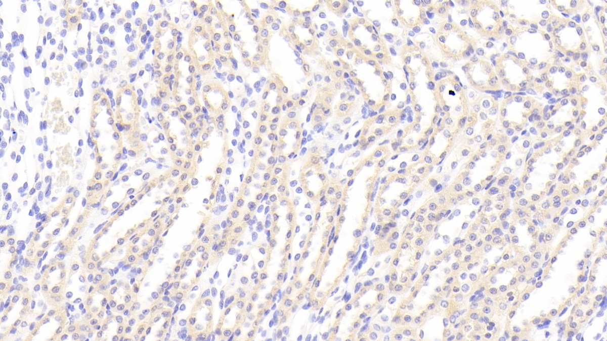 AXL Receptor Tyrosine Kinase (AXL) Rat Polyclonal Antibody