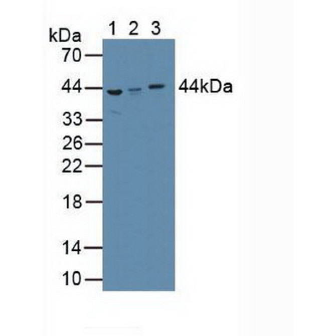 Alpha-2-Glycoprotein 1, Zinc Binding (aZGP1) Human Polyclonal Antibody