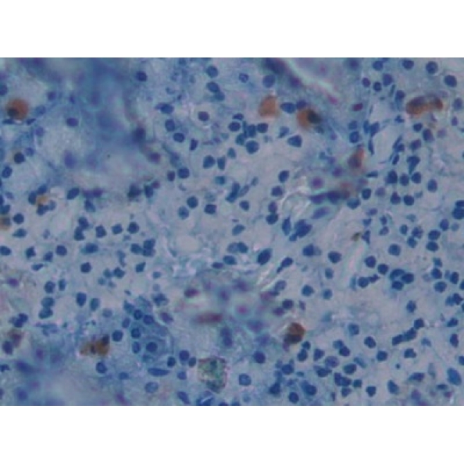 Brother Of CDO Homolog (BOC) Mouse Polyclonal Antibody