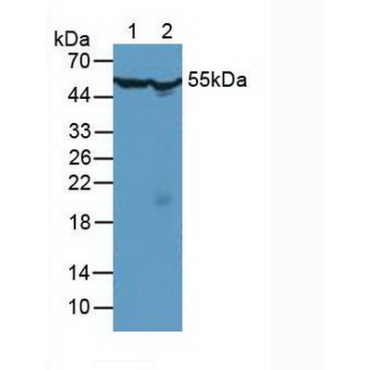 Chaperonin Containing TCP1, Subunit 2 (CCT2) Human Polyclonal Antibody