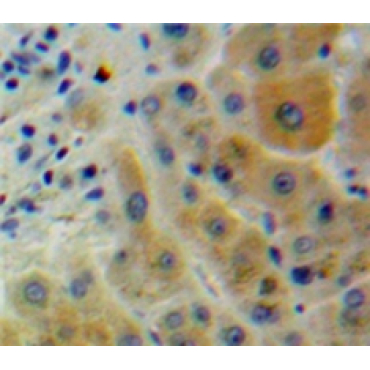 CD2 Associated Protein (CD2AP) Human Polyclonal Antibody