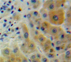 CD2 Associated Protein (CD2AP) Human Polyclonal Antibody