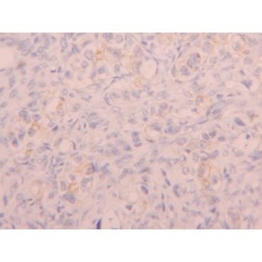 CD5 Antigen Like Protein (CD5L) Human Polyclonal Antibody