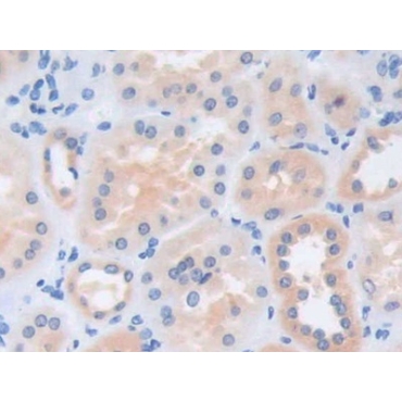 Cat Eye Syndrome Chromosome Region, Candidate 1 (CECR1) Human Polyclonal Antibody