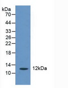 CASP2 And RIPK1 Domain Containing Adaptor With Death Domain Protein (CRADD) Human Polyclonal Antibody