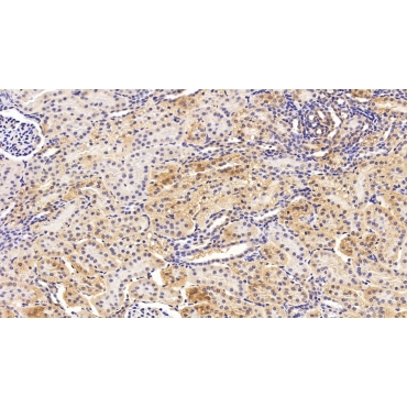 Cytochrome P450 4F2 (CYP4F2) Human Polyclonal Antibody