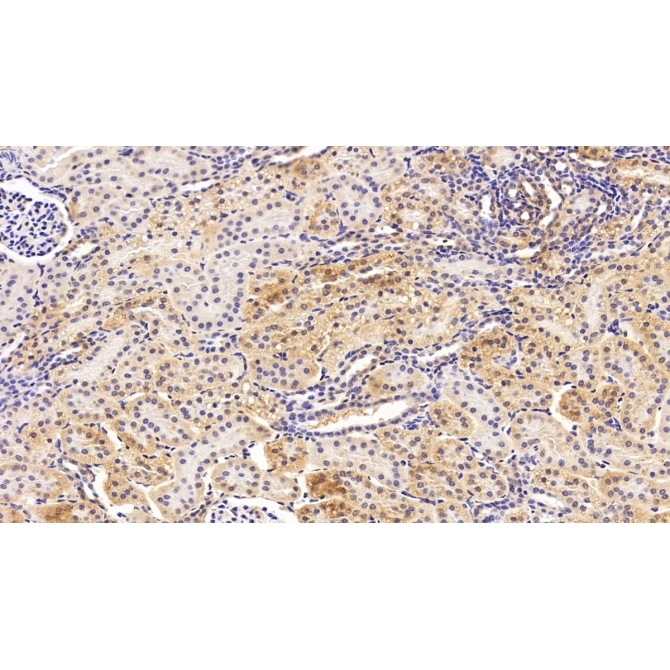 Cytochrome P450 4F2 (CYP4F2) Human Polyclonal Antibody