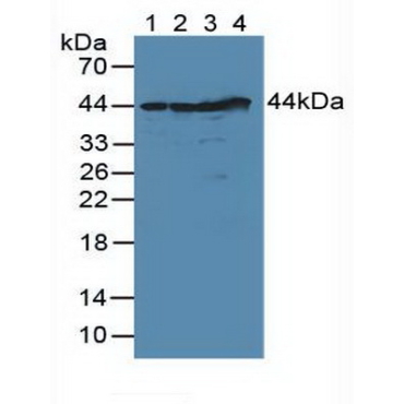 DNA Fragmentation Factor Subunit Alpha (DFFa) Human Polyclonal Antibody