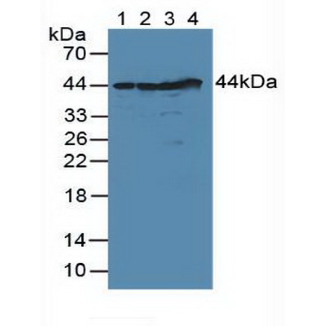 DNA Fragmentation Factor Subunit Alpha (DFFa) Human Polyclonal Antibody