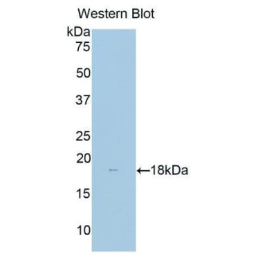 Delta Like 1 Homolog (dLK1) Human Polyclonal Antibody