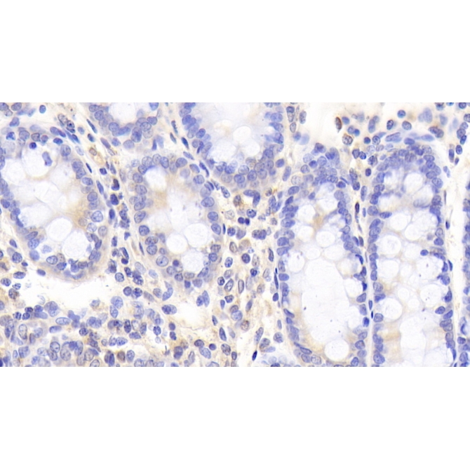 Deltex Homolog 1 (DTX1) Human Polyclonal Antibody
