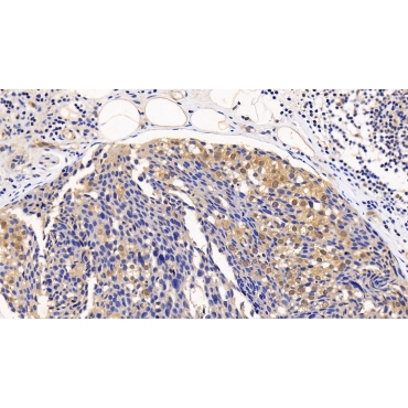Eukaryotic Translation Initiation Factor 4E Binding Protein 1 (EIF4EBP1) Human Polyclonal Antibody