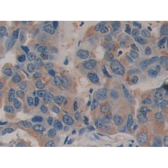 Family With Sequence Similarity 3, Member C (FAM3C) Human Polyclonal Antibody