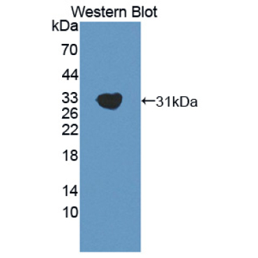 GRB2 Associated Binding Protein 2 (GAB2) Mouse Polyclonal Antibody